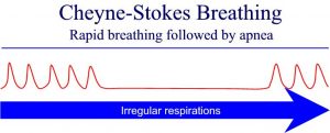 W.B.C.S. Examination Notes On – Cheyne Stokes Breathing – Animal Husbandry And Veterinary Sciences Notes.